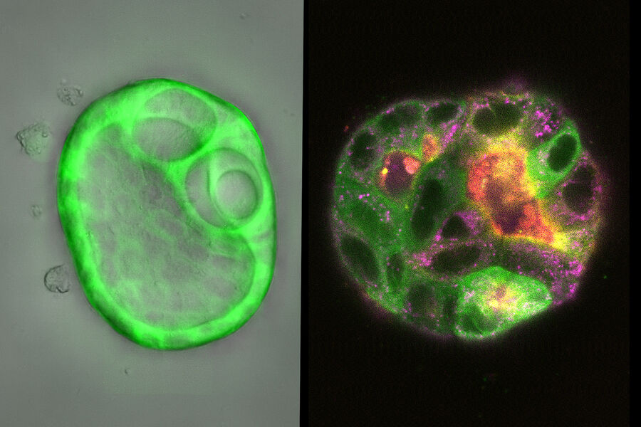 [Translate to chinese:] Cyst formed by MDCK cells 