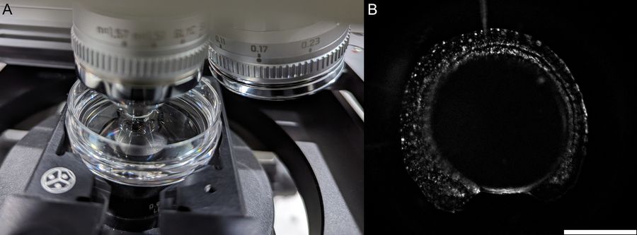 A) THUNDER Imager Tissue configuration used with 16x/0.6 IMM dipping objective. B) Zebrafish embryo image captured using THUNDER live instant computational clearing. Specifically, LED 8 excitation line 555 nm was used at 2% excitation with exposure time of 150 ms to image mKate expression. Scale bar is 300 µm. Image courtesy of Dr. Senthil Arumugam and Laura Kreplin, PhD Student, Monash Biomedicine Discovery Institute, Monash University, Clayton/Melbourne, Australia.
