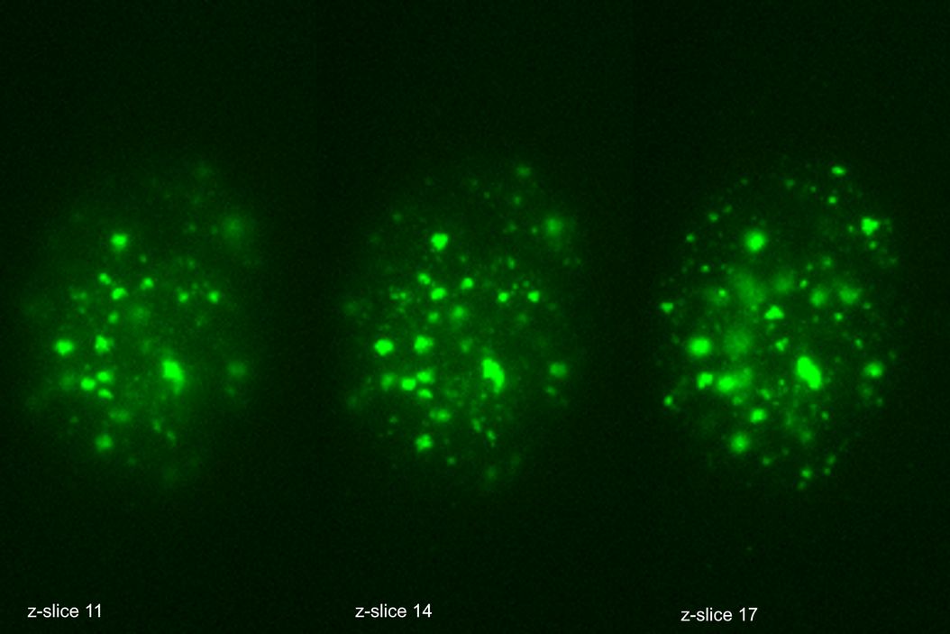 These images illustrate the need for multiple z-slices to capture all gH2Ax foci in a given cell and get an accurate count. 这些图像说明,要捕捉特定细胞中的所有 gH2Ax 病灶并进行精确计数,用多个三维光切片方法实现。 Multiple_Z_slices_to_capture_all_gH2Ax_foci.jpg