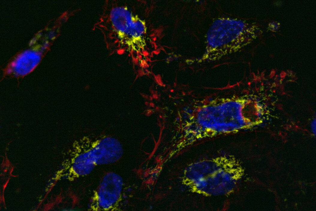 U2OS cells labelled with SiR Actin, TMRE, CellEvent™, and DAPI; 13-hour time-lapse imaging; apoptosis-inducer staurosporine U2OS_cells_with_apoptosis_inducer_added.jpg
