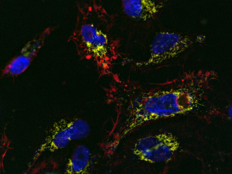 U2OS cells labelled with SiR Actin, TMRE, CellEvent™, and DAPI U2OS cells labelled with SiR Actin, TMRE, CellEvent™, and DAPI; 13-hour time-lapse imaging; apoptosis-inducer staurosporine