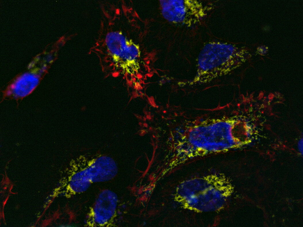[Translate to chinese:] U2OS cells labelled with SiR Actin, TMRE, CellEvent™, and DAPI; 13-hour time-lapse imaging; apoptosis-inducer staurosporine U2OS_cells_with_apoptosis_inducer_added.jpg