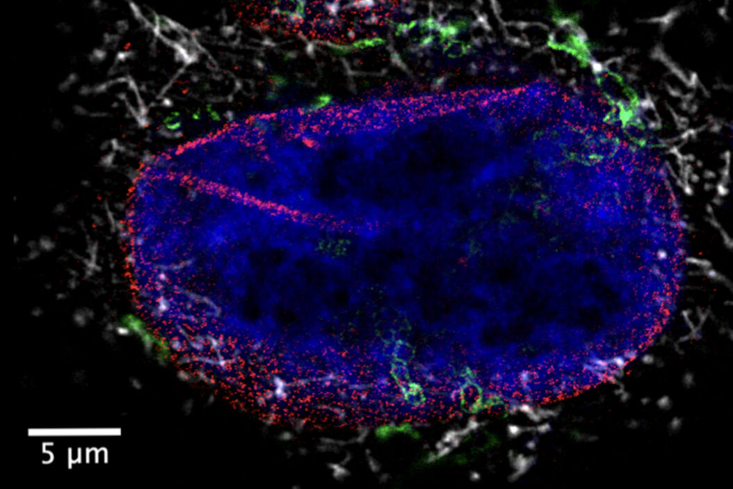  Benefits_of_combining_super-resolution_and_lifetime_teaser.jpg