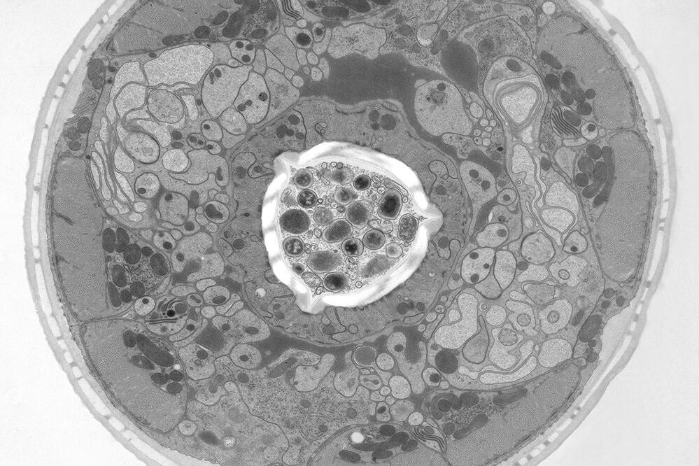 [Translate to chinese:] Structural details of the C. elegans, head in cross-section. Courtesy of Müller-Reichert T, MPI-CBG, Dresden, Germany, and McDonald K, University of California, Berkeley, USA. Figure-0_17.jpg