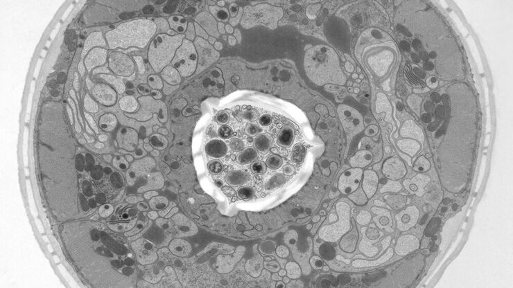 Structural details of the C. elegans, head in cross-section. Courtesy of Müller-Reichert T, MPI-CBG, Dresden, Germany, and McDonald K, University of California, Berkeley, USA. Structural details of the C. elegans, head in cross-section. Courtesy of Müller-Reichert T, MPI-CBG, Dresden, Germany, and McDonald K, University of California, Berkeley, USA.