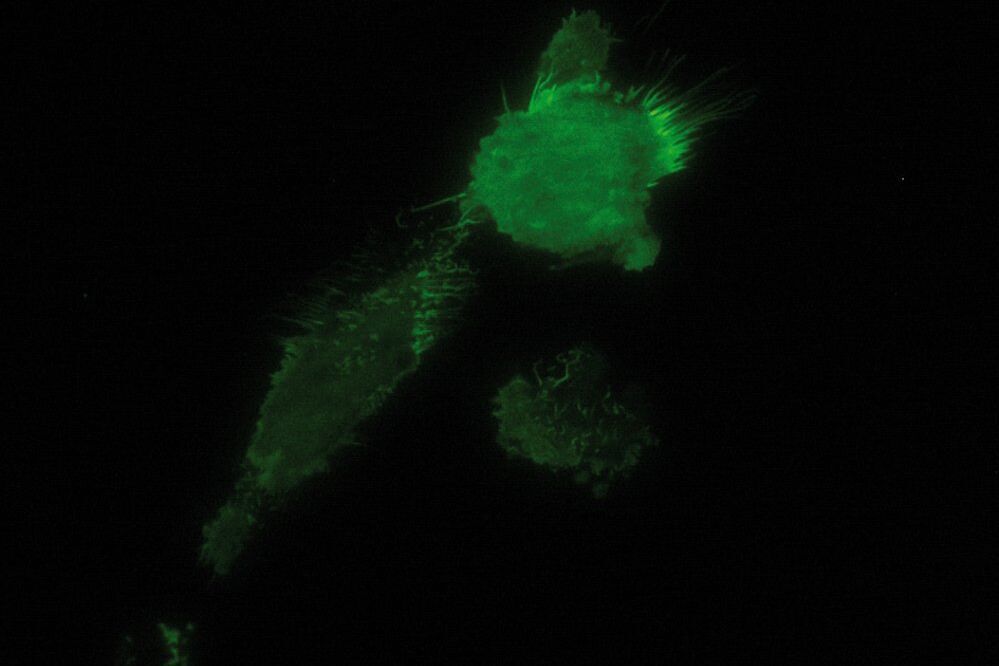 表达 GFP 标记的细胞粘附分子 CD44 的乳腺癌肿瘤细胞的 TIRF 图像，该分子位于细胞膜上，通过 TIRF 成像。 TIRF.jpg
