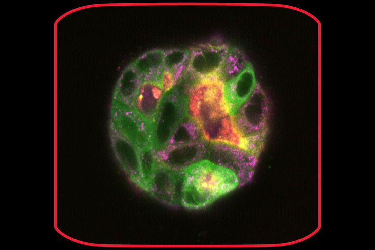 MDCK cysts on day 9