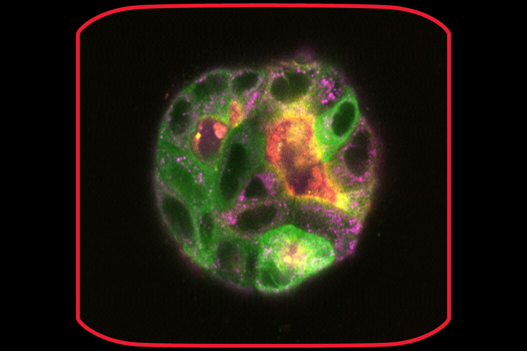 MDCK cysts on day 9 MDCK_cysts_on_day_9_teaser.jpg