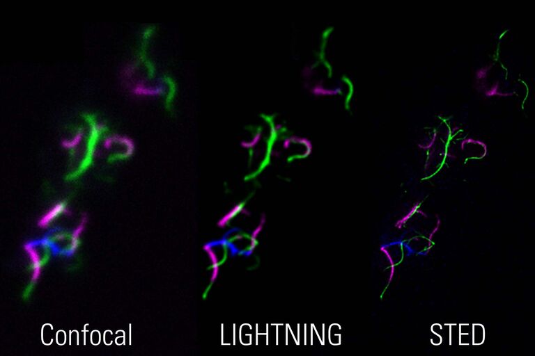 STED 用于微生物学： 使用相关三色共聚焦 LIGHTNING-STED 成像的细菌鞭毛，可使用互补方法研究和验证样本。 样本由德国柏林洪堡大学的 Marc Erhardt 提供。