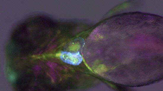 Zebrafish larva with myl7:AmCyan, lmo2:dsRED2, drl:EGFP and Rottermann contrast