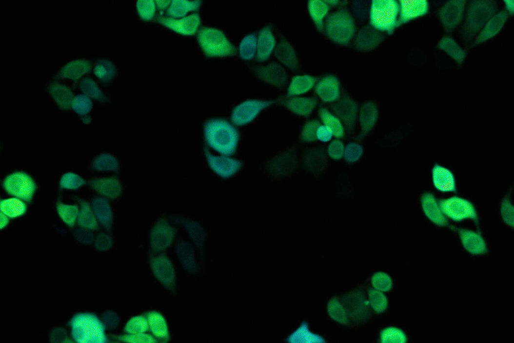  Webinar_Precise_and_lightning-fast_spectral_Fluorescence_Lifetime_Imaging_at_video_rate_Intro.jpg