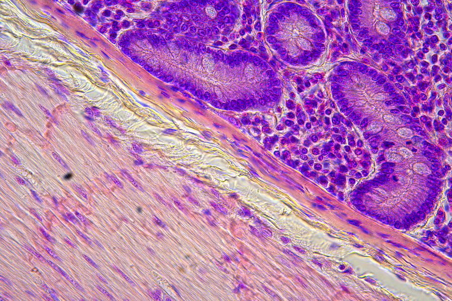[Translate to chinese:] This overview image at 5x magnification shows three distinct layers of tissue in the duodenum