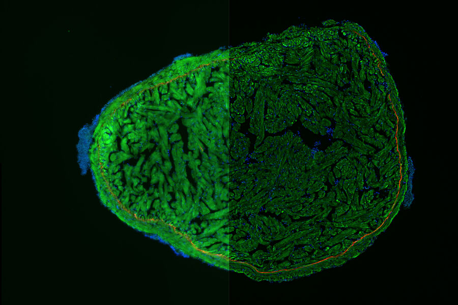 斑马鱼心脏，DAPI（细胞核，蓝色）、Tropomyosin（心肌细胞，红色）和 GFP（初生心脏层，绿色）。成像由THUNDER Tissue成像仪拍摄。瑞士弗里堡大学 Anna Jazwinska 提供。