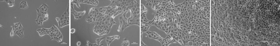 [Translate to chinese:] Example of a cell-growth quick check. MDCK cells with different confluency status. Cell culture images were acquired using Mateo TL in phase-contrast mode.