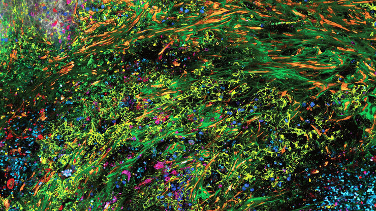 3D high-plex imaging in cancer immunology. Overview of a pancreatic tumor section in mouse model, labeled with 15 markers and imaged in one go using STELLARIS with SpectraPlex. (https://www.nature.com/articles/d42473-024-00260-7)
