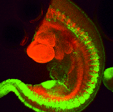小鼠转基因胚胎、肢间体节