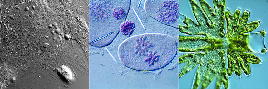小鼠车纤维细胞（结缔组织细胞）、Transdescantia（野花）和微星鼓藻（绿藻）的DIC图像。