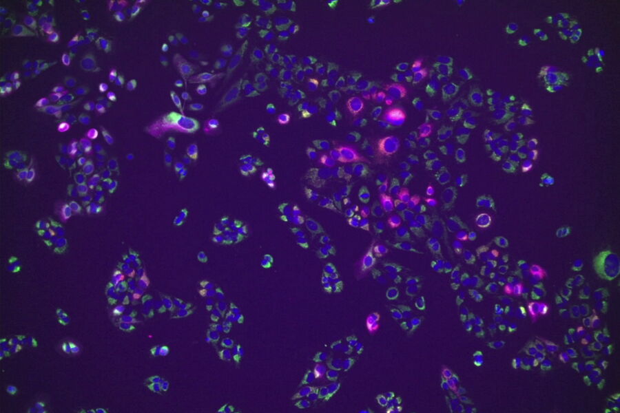 U2OS cells stained with Hoechst for nuclei (blue), MitoTracker green (Mitochondria structure, green) and TMRE (active mitochondria, magenta) and SiR for tubulin (red). Simultaneous acquisition of four channel large area overview using Spiral scan feature using the 10x/1.20 CS2 Water MotCORR objective.