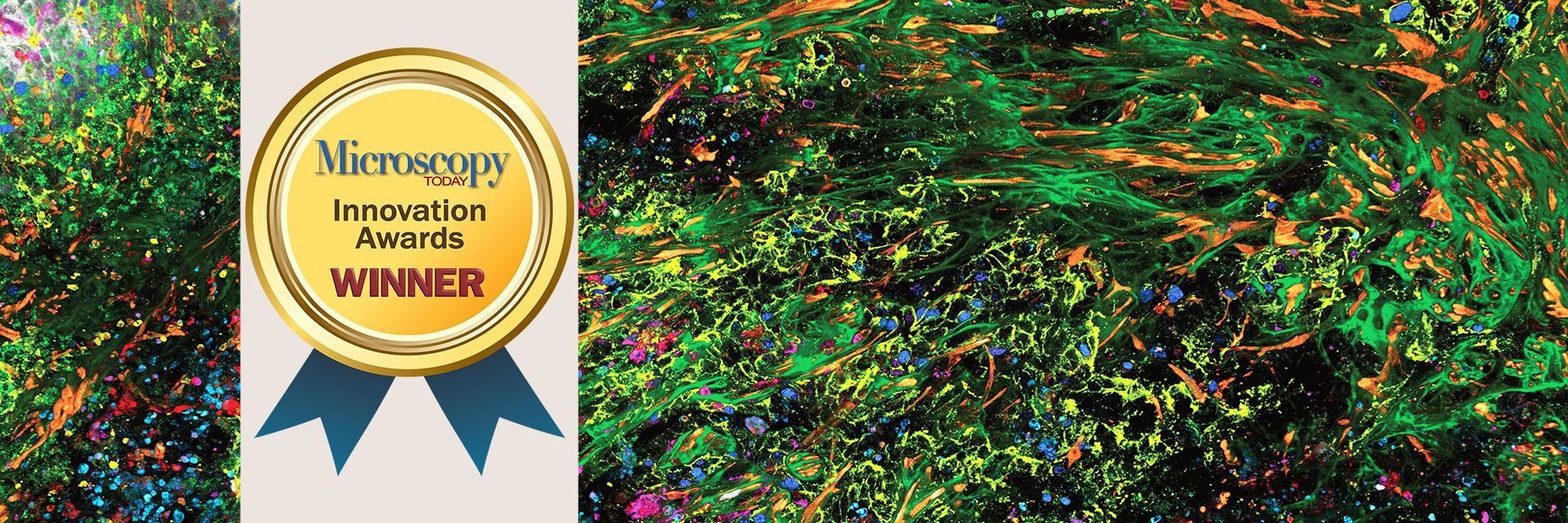 癌症免疫学中的三维超多标成像。Kunz L.、Speziale D.等人，Nat.方法》（2024 年）