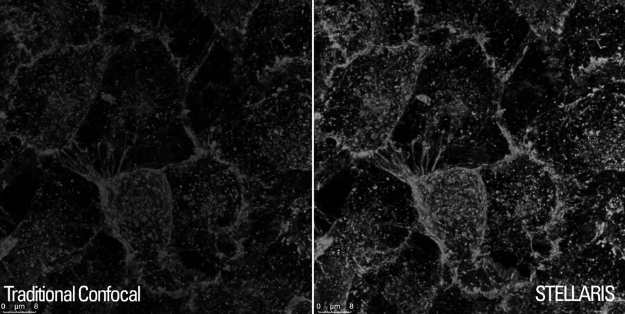 用WGA-CF488染料标记的海拉细胞。 左： 传统的光子计数结果；右： Power Counting的结果。 图中为Z-stack的最大强度投影，用12kHz共振扫描仪获得，用LIGHTNING处理