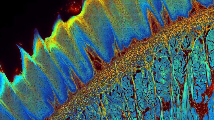 [Translate to chinese:] Transverse histological cut of a rabbit tongue. 50 Mpixels images (2326 µm x 1739 µm) in 14 x 18 tiles. Lifetime gives an additional contrast that allows to differentiate different structures in histological stainings.