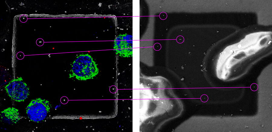 [Translate to chinese:] Maximum projection of 3D confocal image (left) and top view SEM image (right). 