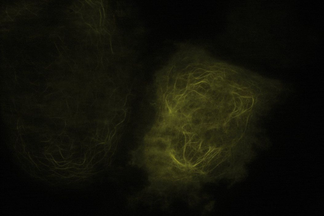 微管蛋白的 TIRF 图像，YFP 标记，穿透深度：120 毫米 2_Tubulin-YFP-TIRF-120mm.jpg