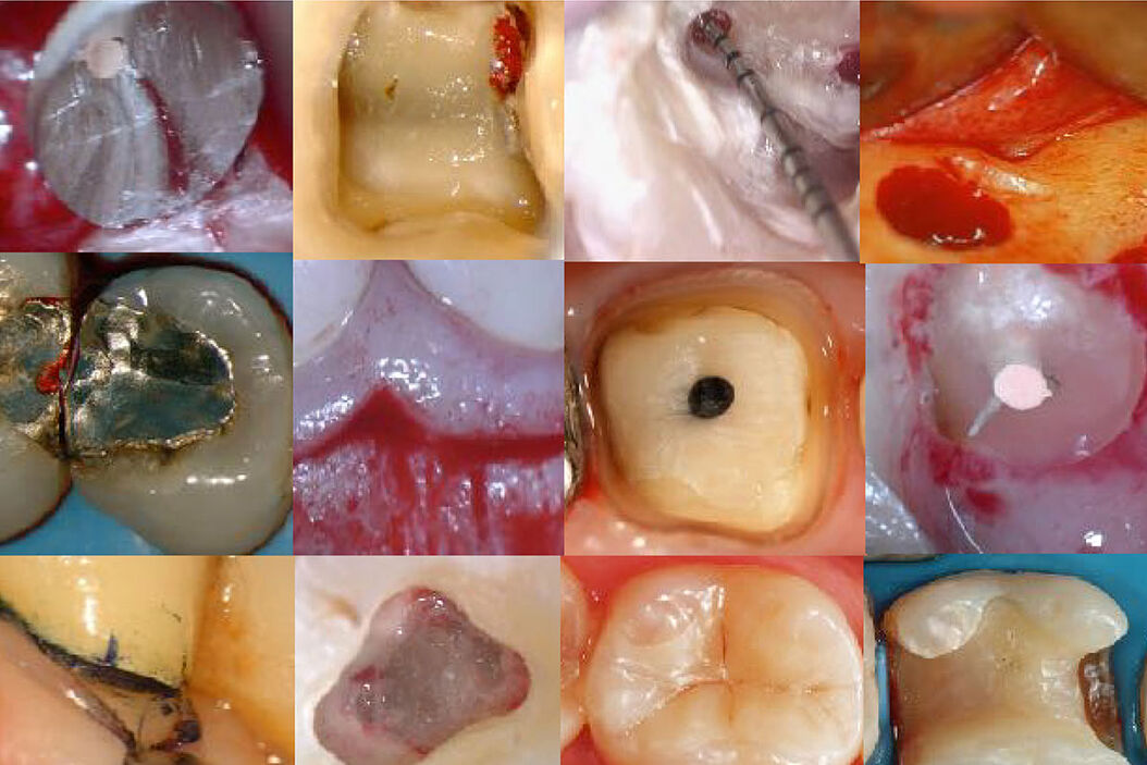  From-dentistry-to-microdentistry_01.jpg