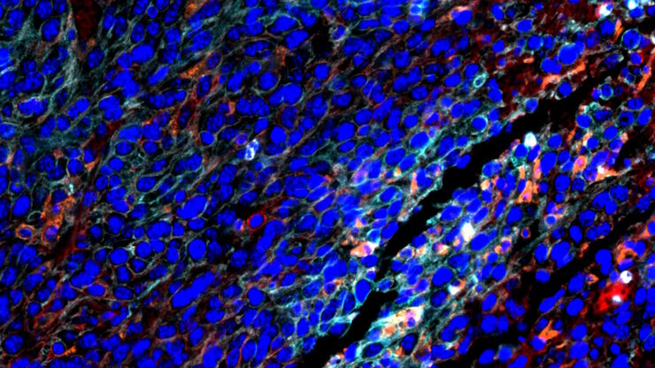 Clustering based analysis reveals various immune cell populations enriched in tumor cells within CT26.WT syngeneic mouse tumor models. 