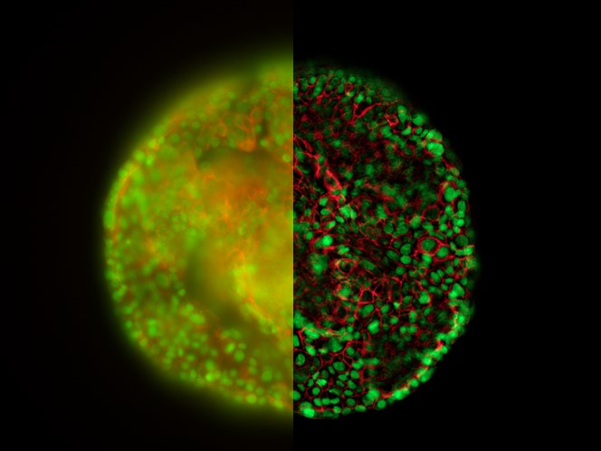 图6：室温下THUNDER高分辨快速成像在Hela细胞球上的应用