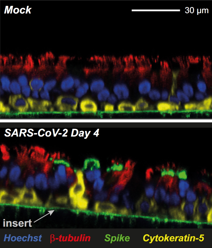 图1：对照样品品（Mock）和受SARS-CoV-2感染的上皮细胞在被感染4天后的共聚焦成像（正交切片）。标记纤毛细胞的β-微管蛋白IV（红色）、基底细胞的细胞角蛋白-5（黄色）、细胞核的DNA（Hoechst、蓝色）、受感染细胞的SARS-CoV-2刺突（绿色）。2B中的绿线是由于插入多孔膜的自发荧光所致