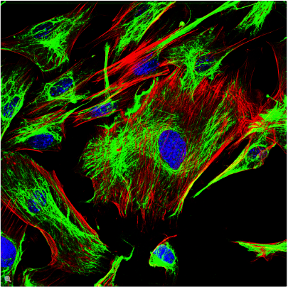 图3：小鼠成纤维细胞，绿色：F-肌动蛋白，FITC，红色：微管蛋白，Cy5，蓝色：细胞核，DAPI。感谢德国海德堡Max Planck医学研究所Günter Giese博士提供的图片。