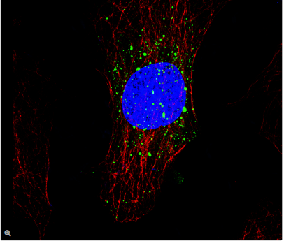 图2：COS 7细胞，绿色：无特征蛋白质，GFP，红色：α-微管蛋白，Cy3，蓝色：细胞核，DAPI。感谢中国上海SIBS、CAS、生物化学与细胞生物学研究所边玮提供的图片。