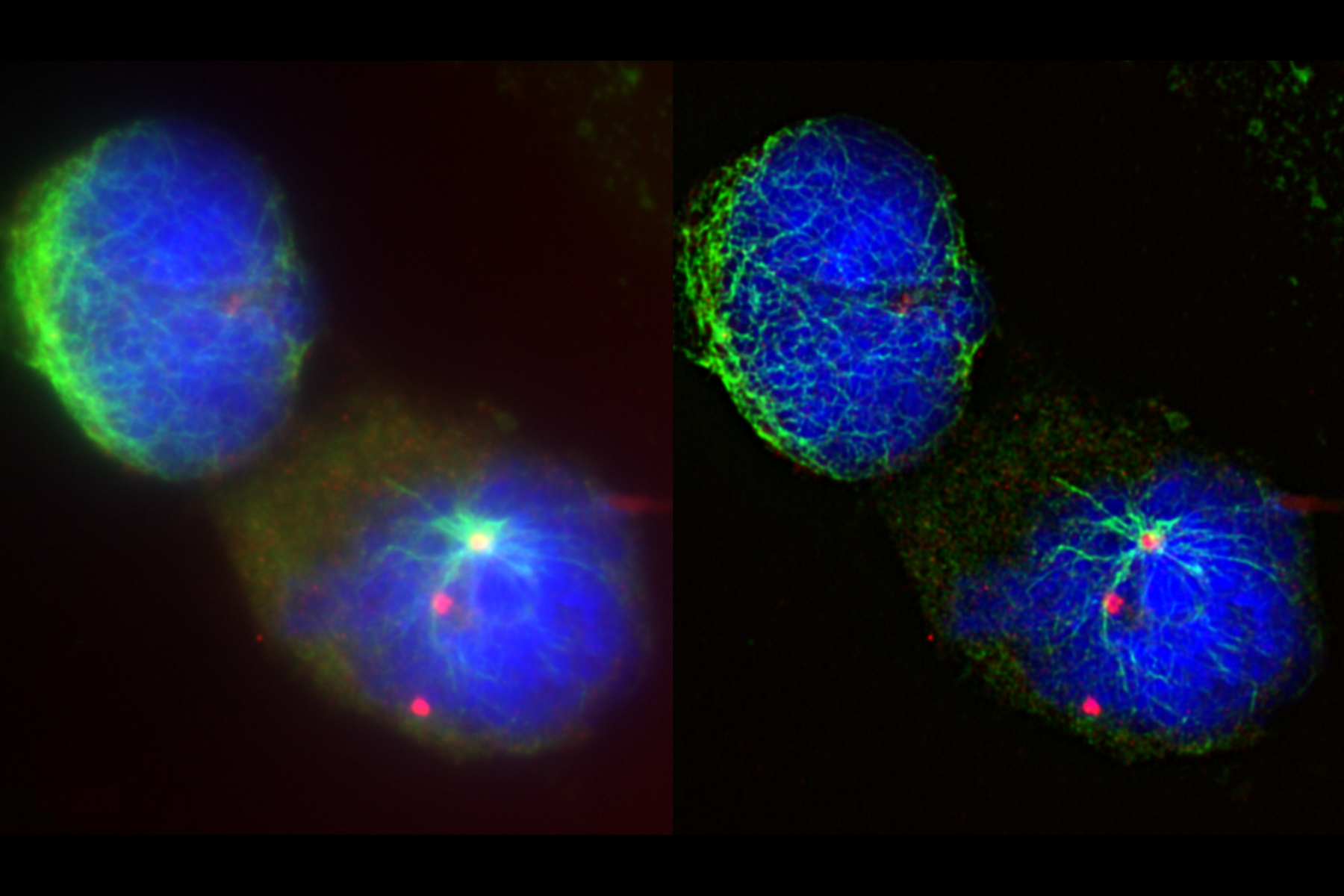 [Translate to chinese:] Raw widefield (left) and THUNDER (right) image of Ewing Sarcoma cells (SK-ES-1).