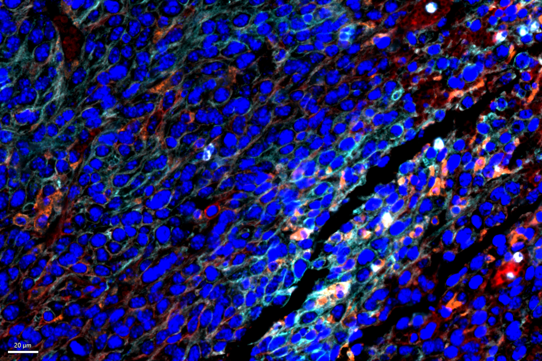 Clustering based analysis reveals various immune cell populations enriched in tumor cells within CT26.WT syngeneic mouse tumor models. 