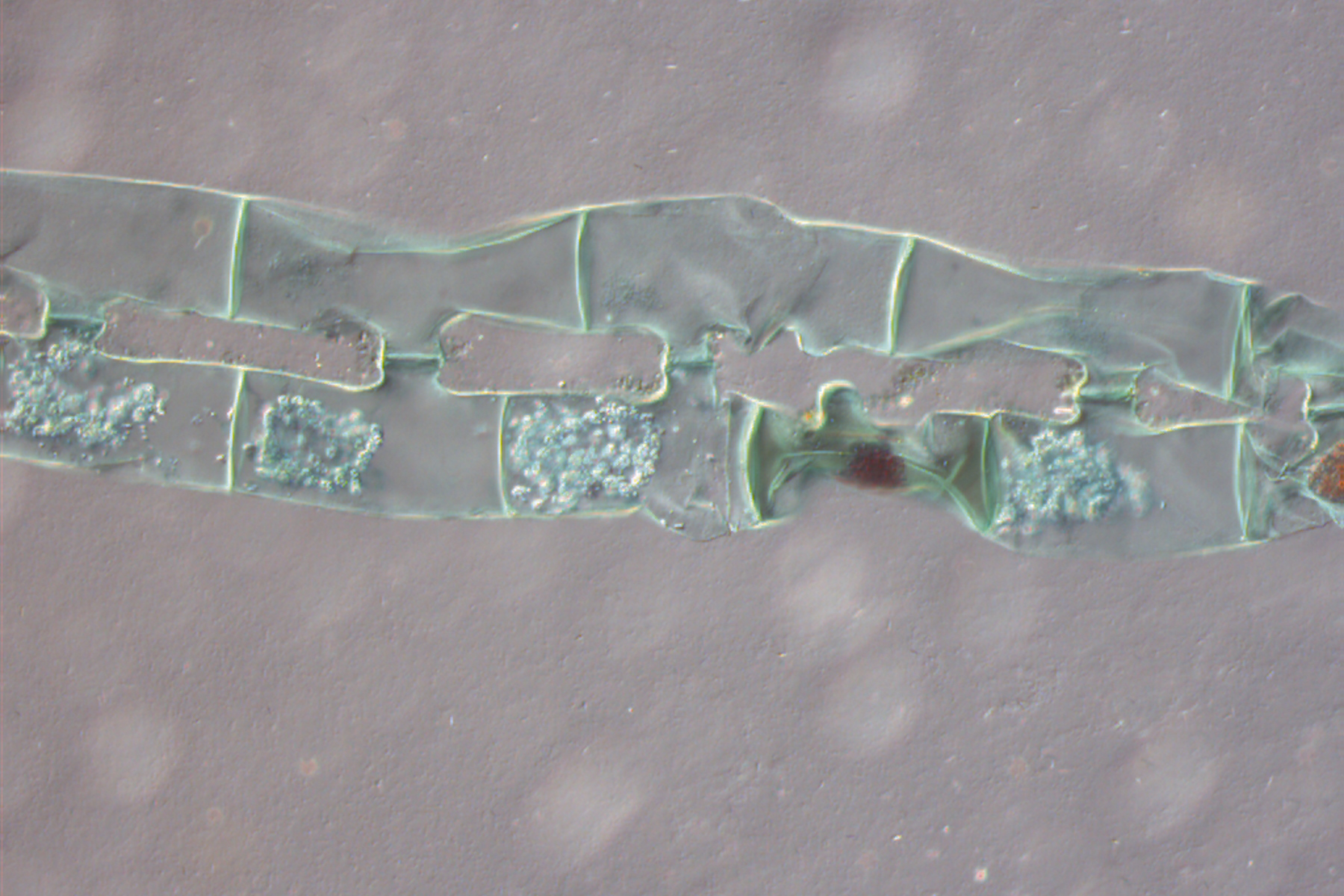 Spirogyra algae (Conjugation), Transmitted Light Differential Interference Contrast.