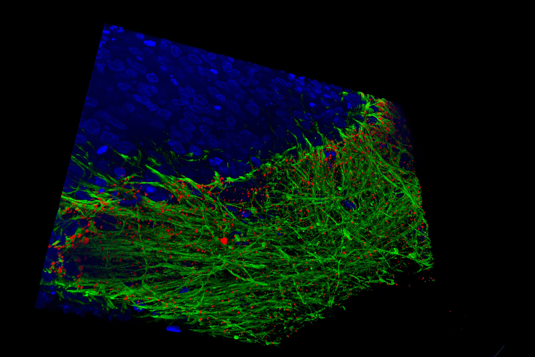 Image: Human stem cell-derived mid brain organoids. Courtesy of Dr Tanya Singh, University of Oxford. 