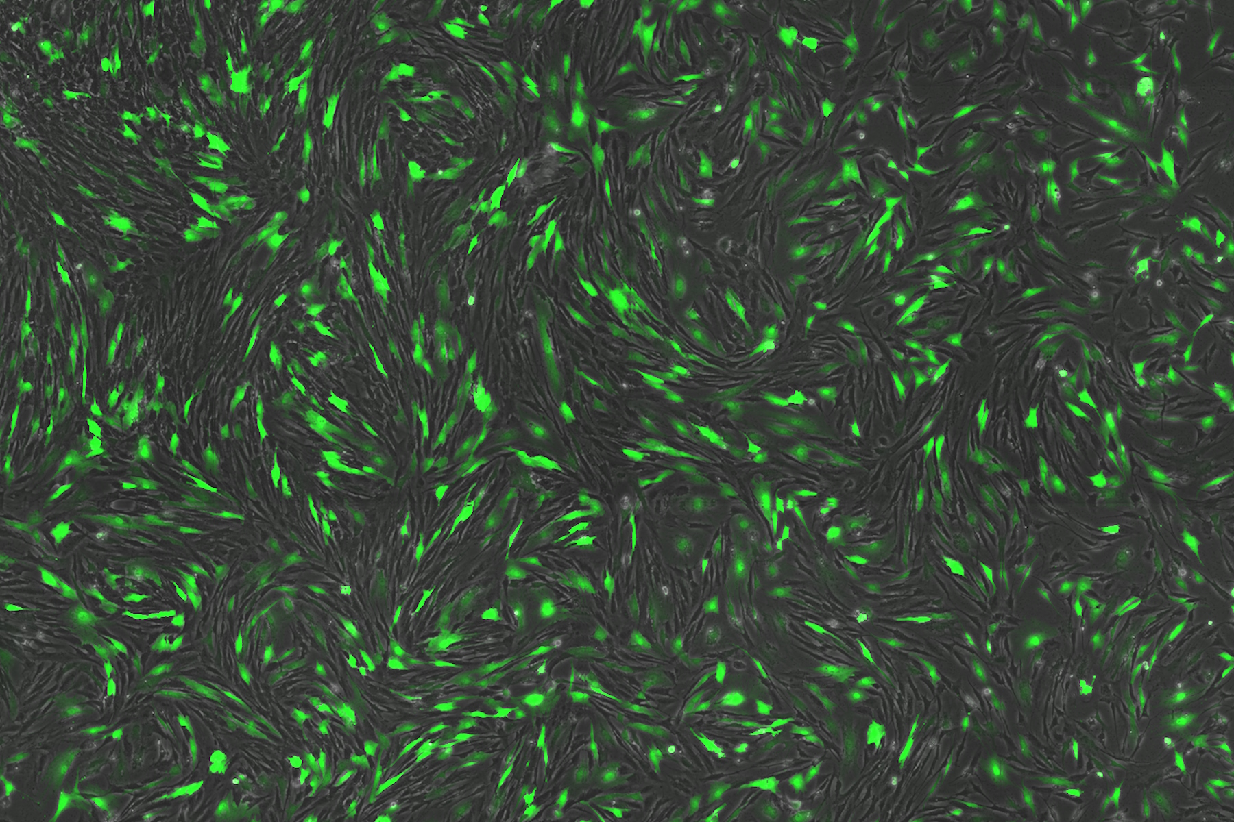 Transfection using the Uncommon Bio reprogramming system. Image acquired using the THUNDER Imager 3D Cell Culture with THUNDER Large Volume Computational Clearing (LVCC) applied. Image courtesy of Samuel East, Uncommon Bio. 