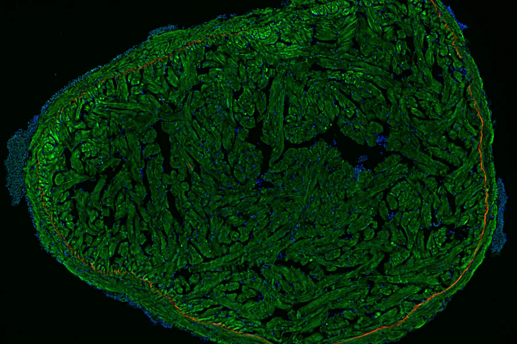 Zebrafish heart, DAPI (nuclei, blue), Tropomyosin (cardiomyocytes, red) and GFP (primordial cardiac layer, green). Courtesy of Anna Jazwinska, University of Fribourg, Switzerland.