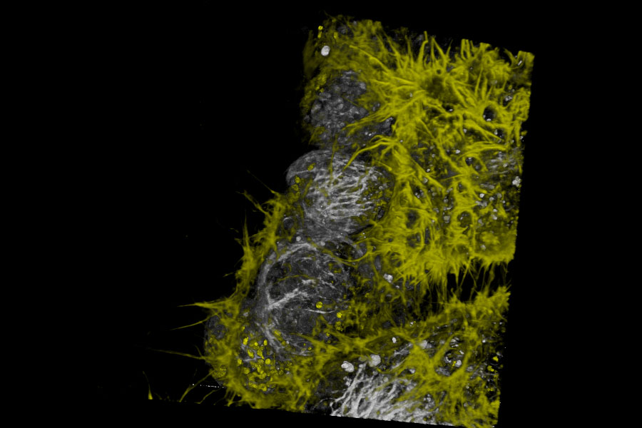 [Translate to chinese:] Live NE-115 cells expressing mNeonGreen-LifeAct are stained with MitoTracker Green, NucRed and SiR Tubulin.