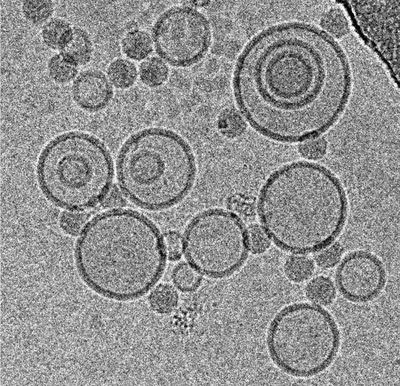 Cryo-electron micrograph of subviral particles of a common cold virus bound to liposomes. Courtesy of Mohit Kumar and Dieter Blaas, MFPL, Vienna (Austria) 