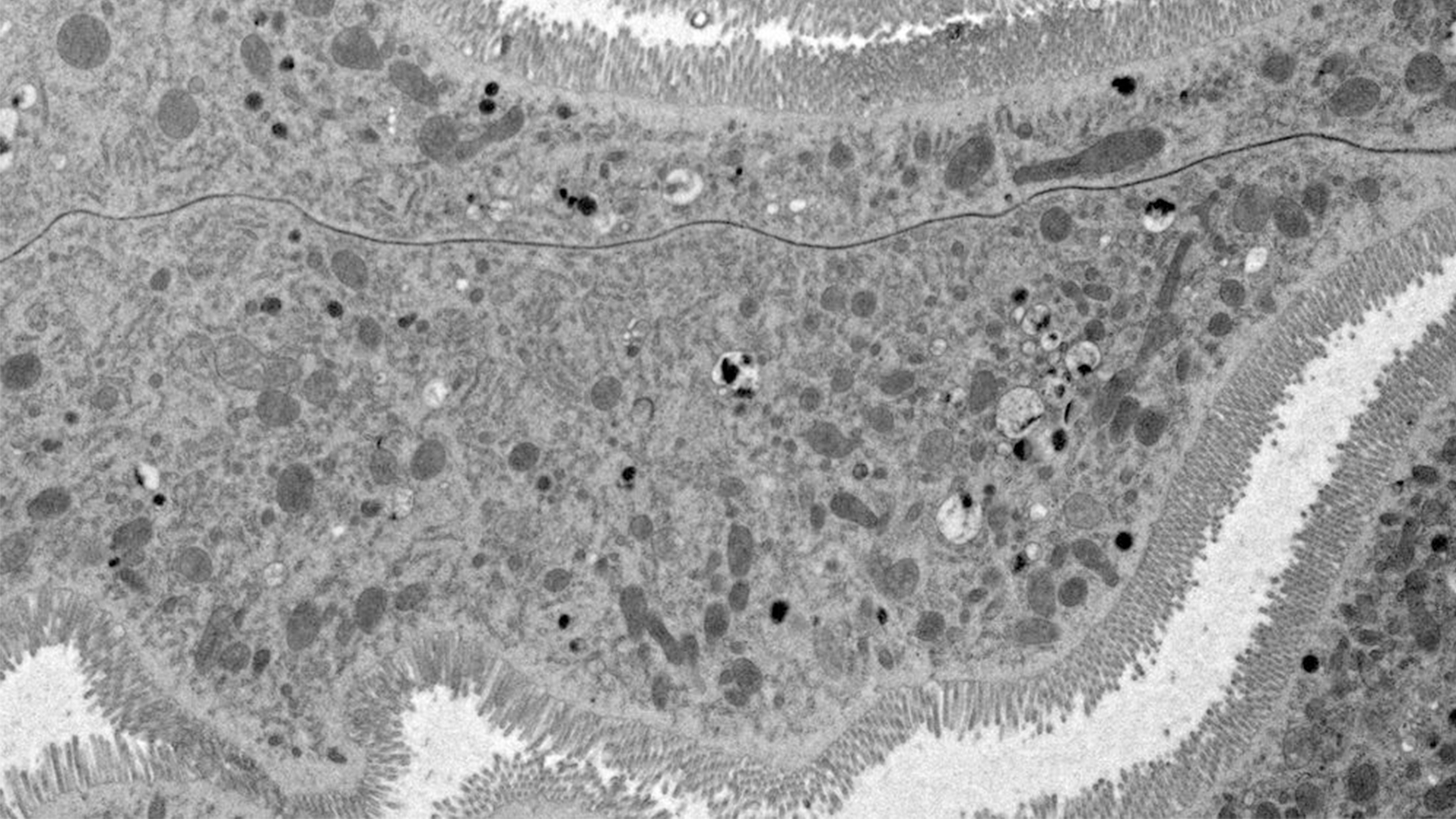 Overview of Drosophila gastric caeca and a mitochondrion with well-defined cristae and well-preserved surrounding membranes. Micrographs courtesy of Dr. Syed (NIH/NIDCR) and Dr. Bleck (NIH/NHLBI) 