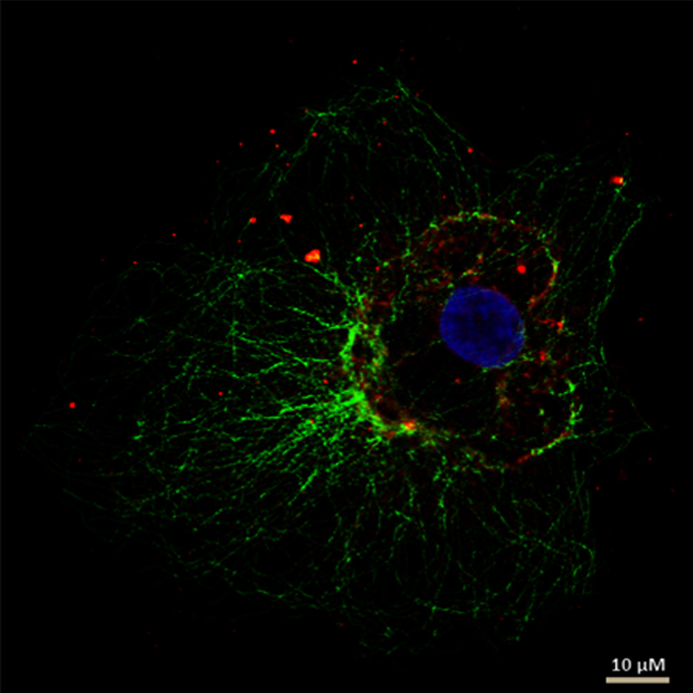 Cellular microtubule network in a fibroblast cell