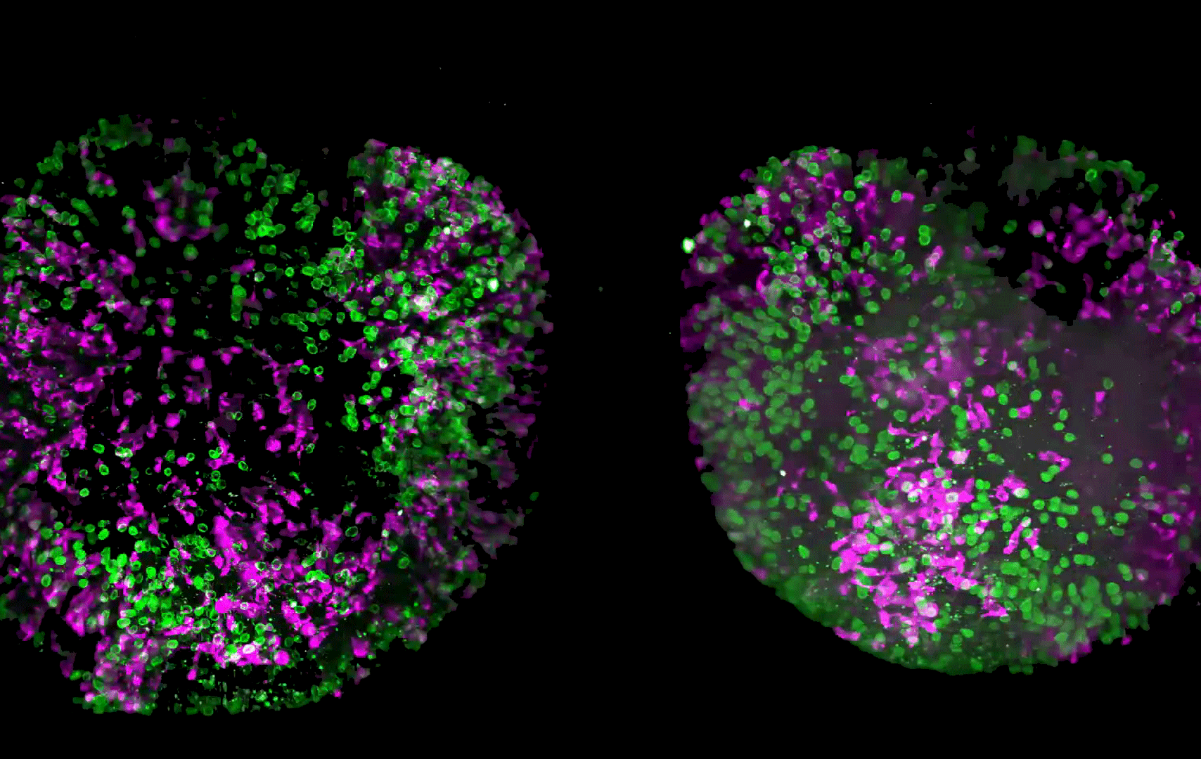 Brain organoids labeled with lamin (green) and tubulin (magenta), acquired using Viventis Deep Dual View Light Sheet Microscope. Courtesy of Akanksha Jain, Treutlein Lab ETH-DBSSE Basel (Switzerland).