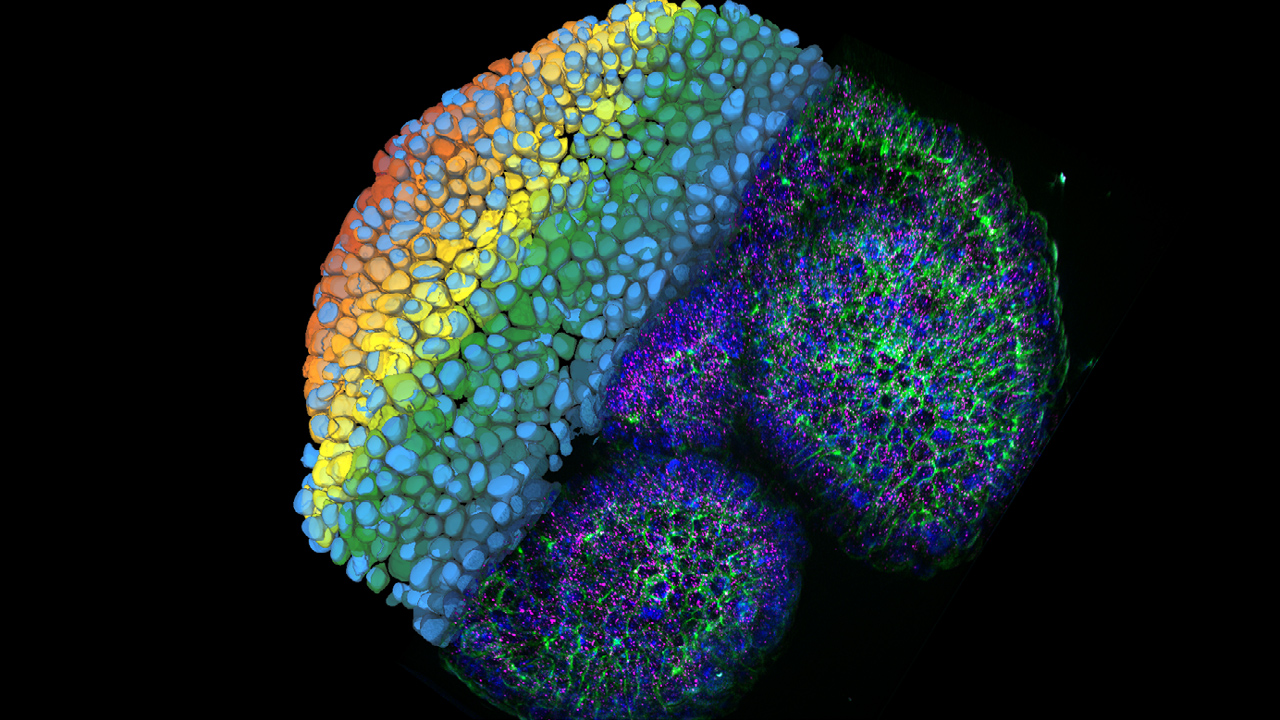 Intestine organoid labelled with DAPI (DNA, blue), plasma membrane dye (green), and smFISH probe (magenta). Image courtesy A. Moor, Biosystems Science and Engineering, ETH Zurich, Switzerland.