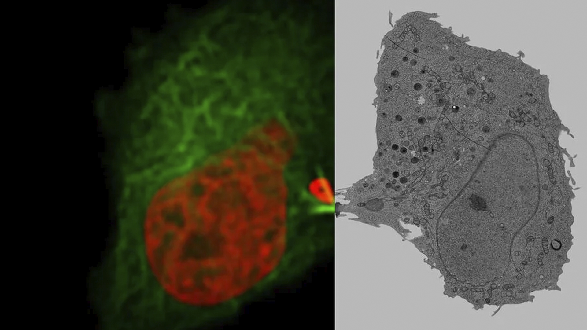 Mammalian cells expressing H2B-mCherry and alphaTubulin-mEGFP to visualize DNA and microtubules respectively. Left: Widefield imaging using THUNDER Imager. Right: Sample after correlated EM imaging using Leica Microsystems Coral Life workflow. Cells were cryo-immobilized by high-pressure freezing 60 min after the onset of cytokinesis. The intercellular bridge was imaged under TEM after freeze substitution and resin infiltration.