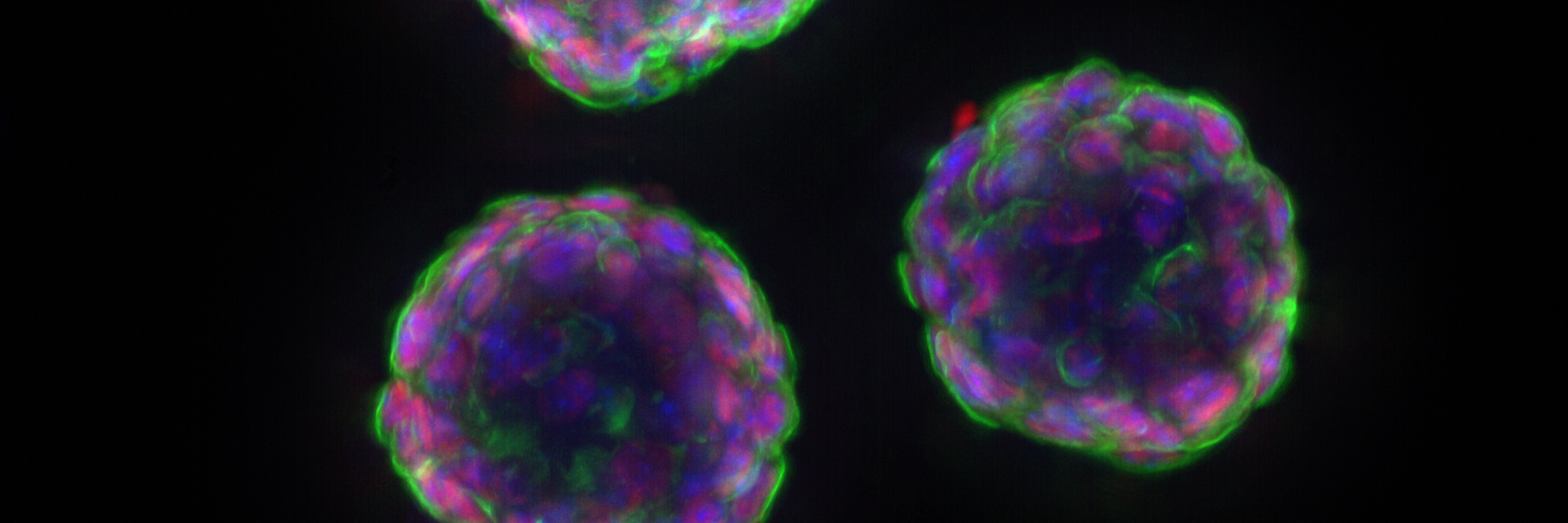 Murine esophageal organoids (DAPI, Integrin26-AF 488, SOX2-AF568) imaged with THUNDER Imager Cell. Courtesy of Dr. F.T. Arroso Martins, Tamere University, Finland.