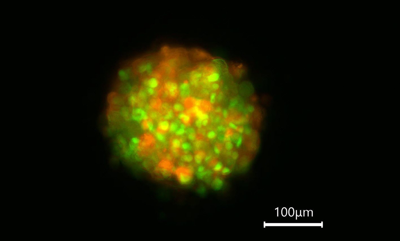 T47D breast cancer cell transformation from adherent culture to spheroid. Fluorescent labeling of nuclei (Histone2B-eGFP) and F-actin (LifeAct-mCherry) reveals cytoskeletal organization and aggregation during ECM development and spheroid formation. Image shows Day 4 of the transformation process: the T47D cells continue to aggregate and develop into a spheroid. Image captured on the Mateo FL.
