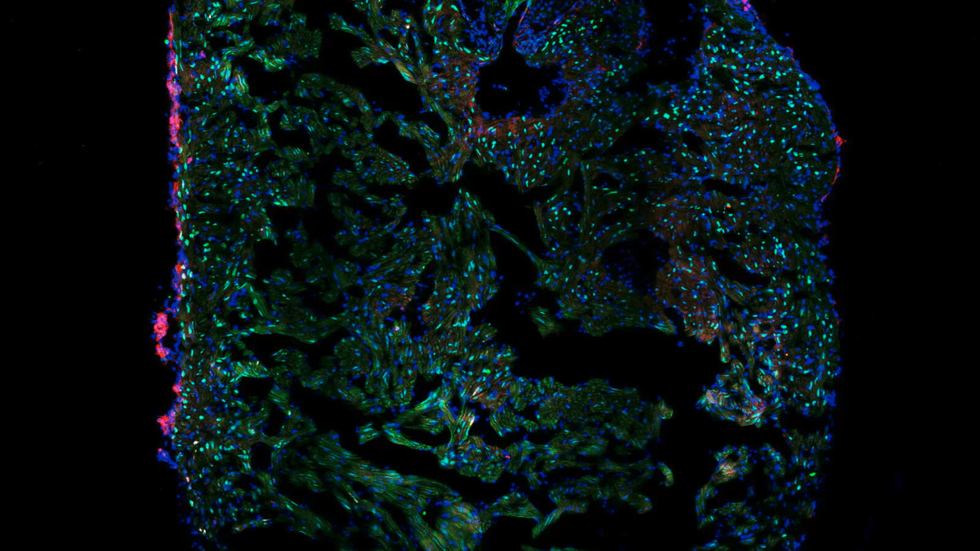 Single slice taken from a zebrafish heart showing the ventricle with an injury in the lower area. Image shows the nuclei of all cells (blue), nuclei of the cardiomyocyte (heart muscle cells, green) and the proliferating cells (red). Image courtesy of Laura Peces-Barba Castaño, Max Planck Institute for Heart and Lung Research. 