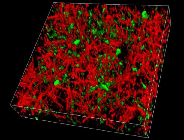 Effortless separation of GFP (green) and YFP (red) expressed in the cortex of a live mouse by capturing either two channels simultaneously or conducting a spectral emission scan and applying channel unmixing in the LAS X software.